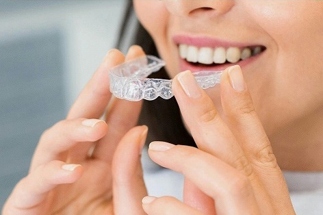 understand your clear aligner treatment plan